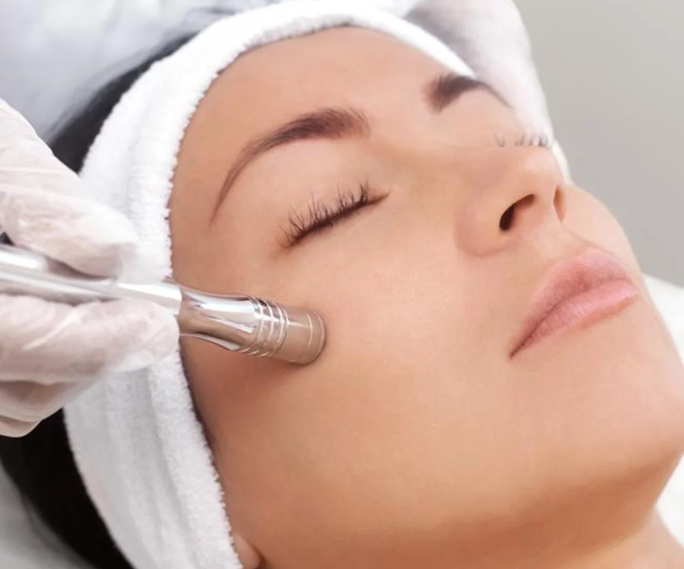 Microdermabrasion